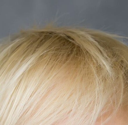 I miei capelli biondi tendono al verde: come rimediare?